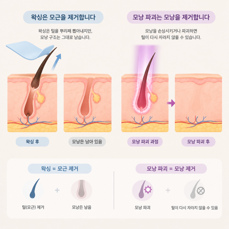 AI 생성 설명 이미지: 임산부 왁싱 도도라인왁싱 파주운정본점 | 모근 제거와 모낭 파괴의 차이